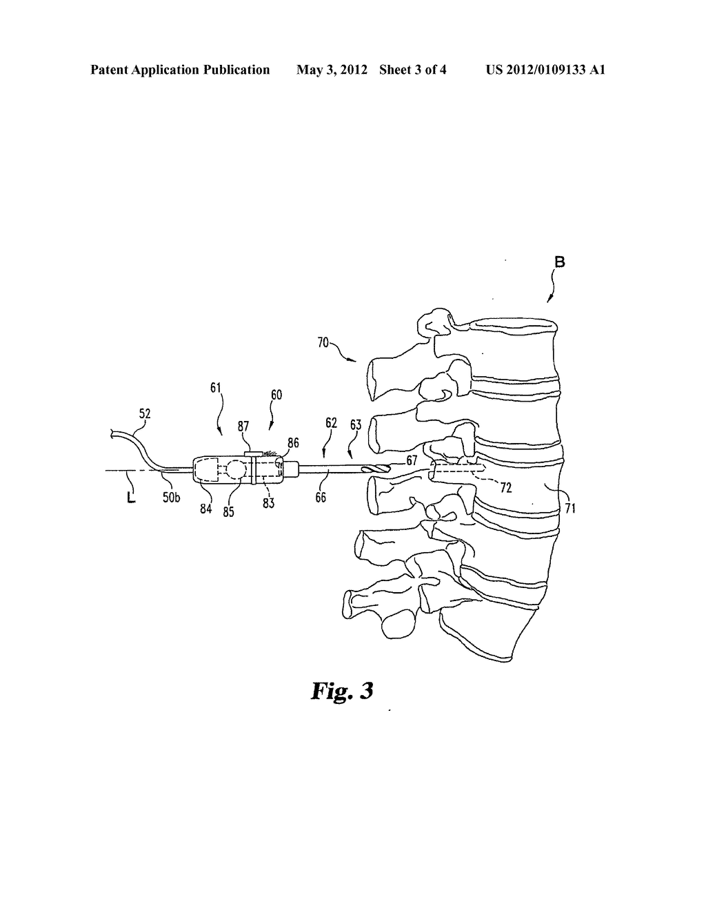 Device and Method for Operating a Tool Relative to Bone Tissue and     Detecting Neural Elements - diagram, schematic, and image 04