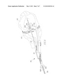 OVAL TIBIA GUIDE diagram and image