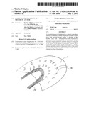 ELEMENTS FOR VERSATILITY OF A PROSTHETIC ANCHOR diagram and image