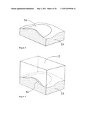 ELEMENTS FOR VERSATILITY OF A PROSTHETIC ANCHOR diagram and image