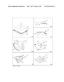 ELEMENTS FOR VERSATILITY OF A PROSTHETIC ANCHOR diagram and image