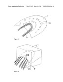 ELEMENTS FOR VERSATILITY OF A PROSTHETIC ANCHOR diagram and image