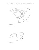 ELEMENTS FOR VERSATILITY OF A PROSTHETIC ANCHOR diagram and image