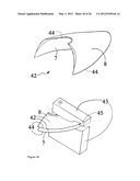 ELEMENTS FOR VERSATILITY OF A PROSTHETIC ANCHOR diagram and image