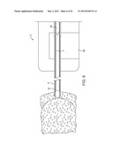 METHODS AND DEVICES FOR REMOVING TISSUE FROM A PATIENT AND PLACING A     MARKER IN THE PATIENT diagram and image