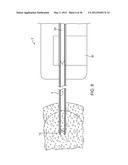 METHODS AND DEVICES FOR REMOVING TISSUE FROM A PATIENT AND PLACING A     MARKER IN THE PATIENT diagram and image