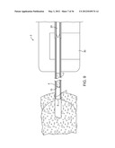 METHODS AND DEVICES FOR REMOVING TISSUE FROM A PATIENT AND PLACING A     MARKER IN THE PATIENT diagram and image