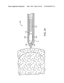 METHODS AND DEVICES FOR REMOVING TISSUE FROM A PATIENT AND PLACING A     MARKER IN THE PATIENT diagram and image