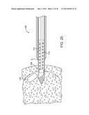 METHODS AND DEVICES FOR REMOVING TISSUE FROM A PATIENT AND PLACING A     MARKER IN THE PATIENT diagram and image