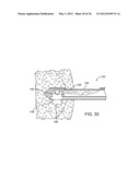 METHODS AND DEVICES FOR REMOVING TISSUE FROM A PATIENT AND PLACING A     MARKER IN THE PATIENT diagram and image