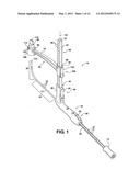 Method of Performing a Suprapubic Transurethral Cystostomy diagram and image