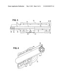 Method of Performing a Suprapubic Transurethral Cystostomy diagram and image