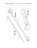 Method of Performing a Suprapubic Transurethral Cystostomy diagram and image