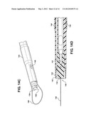 Method of Performing a Suprapubic Transurethral Cystostomy diagram and image