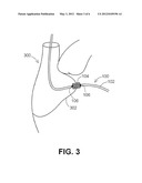 DEVICES, SYSTEMS, AND METHODS FOR CLOSING AN APERTURE IN A BODILY TISSUE diagram and image