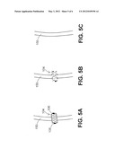 DEVICES, SYSTEMS, AND METHODS FOR CLOSING AN APERTURE IN A BODILY TISSUE diagram and image