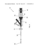 ADHESIVE-BASED VARICOSE VEIN TREATMENT diagram and image