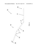 ADHESIVE-BASED VARICOSE VEIN TREATMENT diagram and image