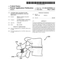 ASSEMBLEABLE JACK BRACES FOR SEATING AND SUPPORTING ANGULAR PROCESSES diagram and image