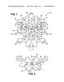 ASSEMBLEABLE JACK BRACES FOR SEATING AND SUPPORTING ANGULAR PROCESSES diagram and image