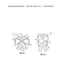 ASSEMBLEABLE JACK BRACES FOR SEATING AND SUPPORTING ANGULAR PROCESSES diagram and image