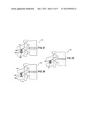 ASSEMBLEABLE JACK BRACES FOR SEATING AND SUPPORTING ANGULAR PROCESSES diagram and image