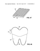 ASSEMBLEABLE JACK BRACES FOR SEATING AND SUPPORTING ANGULAR PROCESSES diagram and image