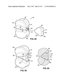 ASSEMBLEABLE JACK BRACES FOR SEATING AND SUPPORTING ANGULAR PROCESSES diagram and image