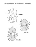 ASSEMBLEABLE JACK BRACES FOR SEATING AND SUPPORTING ANGULAR PROCESSES diagram and image