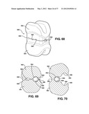 ASSEMBLEABLE JACK BRACES FOR SEATING AND SUPPORTING ANGULAR PROCESSES diagram and image