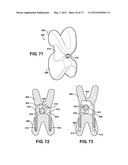 ASSEMBLEABLE JACK BRACES FOR SEATING AND SUPPORTING ANGULAR PROCESSES diagram and image