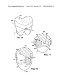 ASSEMBLEABLE JACK BRACES FOR SEATING AND SUPPORTING ANGULAR PROCESSES diagram and image