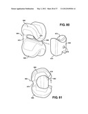 ASSEMBLEABLE JACK BRACES FOR SEATING AND SUPPORTING ANGULAR PROCESSES diagram and image