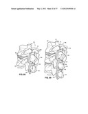 ASSEMBLEABLE JACK BRACES FOR SEATING AND SUPPORTING ANGULAR PROCESSES diagram and image