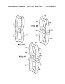 ASSEMBLEABLE JACK BRACES FOR SEATING AND SUPPORTING ANGULAR PROCESSES diagram and image