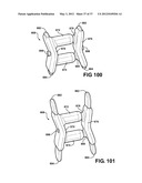 ASSEMBLEABLE JACK BRACES FOR SEATING AND SUPPORTING ANGULAR PROCESSES diagram and image