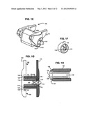 Systems and Methods for In Situ Assembly of an Interspinous Process     Distraction Implant diagram and image