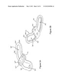 OCCIPITAL FIXATION SYSTEM AND METHOD OF USE diagram and image