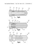 DYNAMIC BONE FIXATION ELEMENT AND METHOD OF USING THE SAME diagram and image