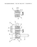 DYNAMIC BONE FIXATION ELEMENT AND METHOD OF USING THE SAME diagram and image