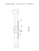 BONE PLATE AND BONE PLATE ASSEMBLIES INCLUDING POLYAXIAL FASTENERS diagram and image