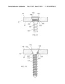 BONE PLATE AND BONE PLATE ASSEMBLIES INCLUDING POLYAXIAL FASTENERS diagram and image