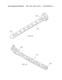 BONE PLATE AND BONE PLATE ASSEMBLIES INCLUDING POLYAXIAL FASTENERS diagram and image