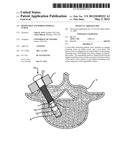 Removable Anchoring Pedicle Screw diagram and image