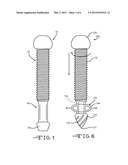 Removable Anchoring Pedicle Screw diagram and image