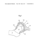 HIP JOINT INSTRUMENT AND METHOD diagram and image