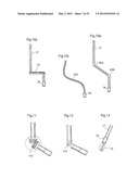 HIP JOINT INSTRUMENT AND METHOD diagram and image