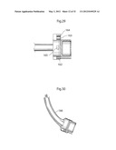 HIP JOINT INSTRUMENT AND METHOD diagram and image