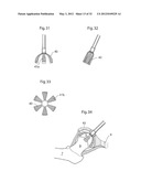 HIP JOINT INSTRUMENT AND METHOD diagram and image