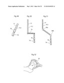 HIP JOINT INSTRUMENT AND METHOD diagram and image